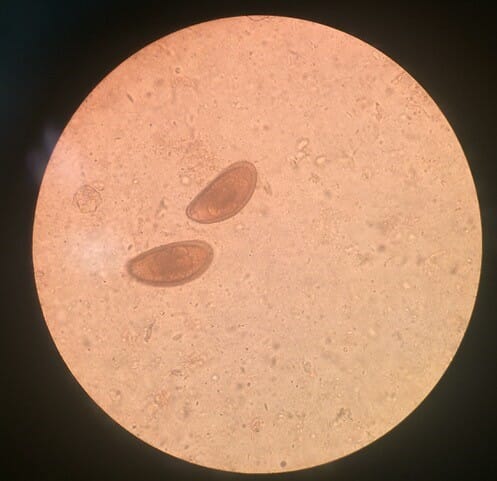 Figure (2) Pinworm eggs found in a faecal float performed on a bearded dragon (Pogona vitticeps)