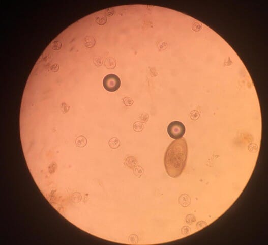 Figure (3) Isospora oocysts and a pinworm egg, identified in a direct faecal smear from a panther chameleon (Furcifer pardalis)