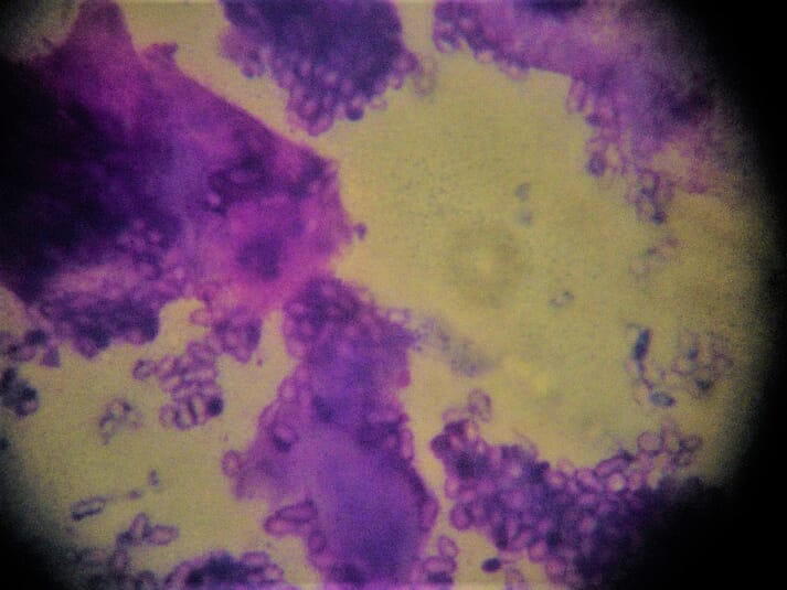 FIGURE (6) Tape strip cytology is an effective way of identifying Malassezia organisms in cats