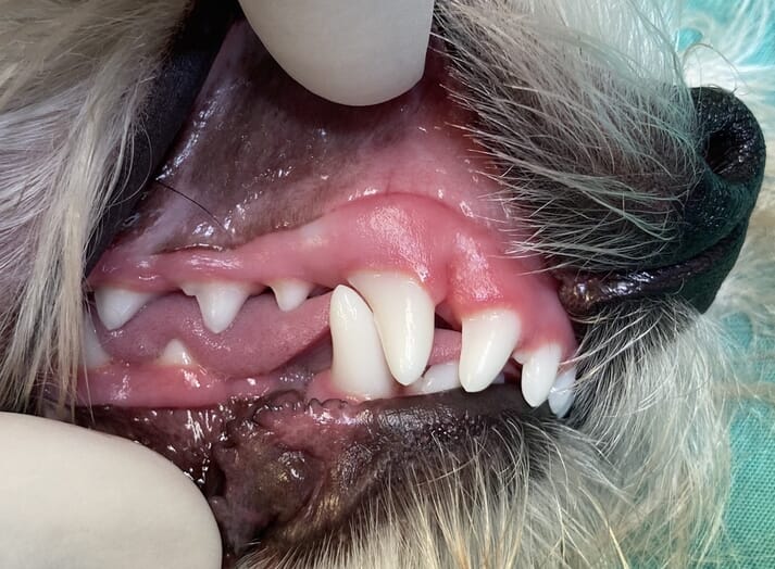 FIGURE (1) With severe mandibular linguoversion, like in this case, the mandibular canine occludes at the distal aspect of the right maxillary canine tooth. So, an obvious malocclusion but not a severe traumatic occlusion. Based on this alone, intervention could be very conservative, if at all