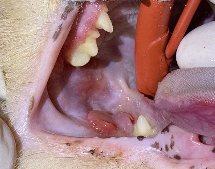 FIGURE (5) Odontoplasty was performed to reduce crown height of the right maxillary fourth premolar to prevent impingement on the buccal aspect of where the right mandibular first molar was extracted earlier. An inflammatory granuloma developed at this site