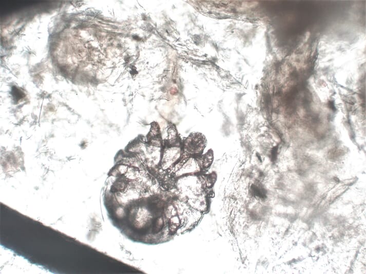 Microscopic image of Sarcoptes scabiei mites