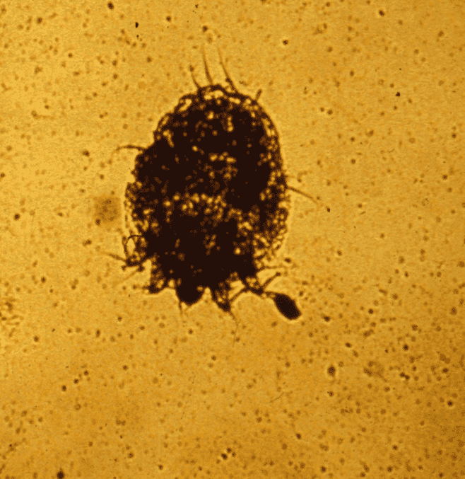 FIGURE (1) Sarcoptes scabiei can be mounted in liquid paraffin to aid identification. The rudimentary hind legs do not protrude beyond the body. The mites are small, at 200 to 400 microns