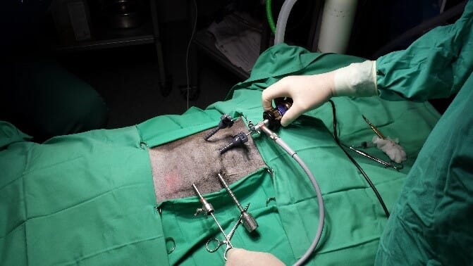Thoracoscopy