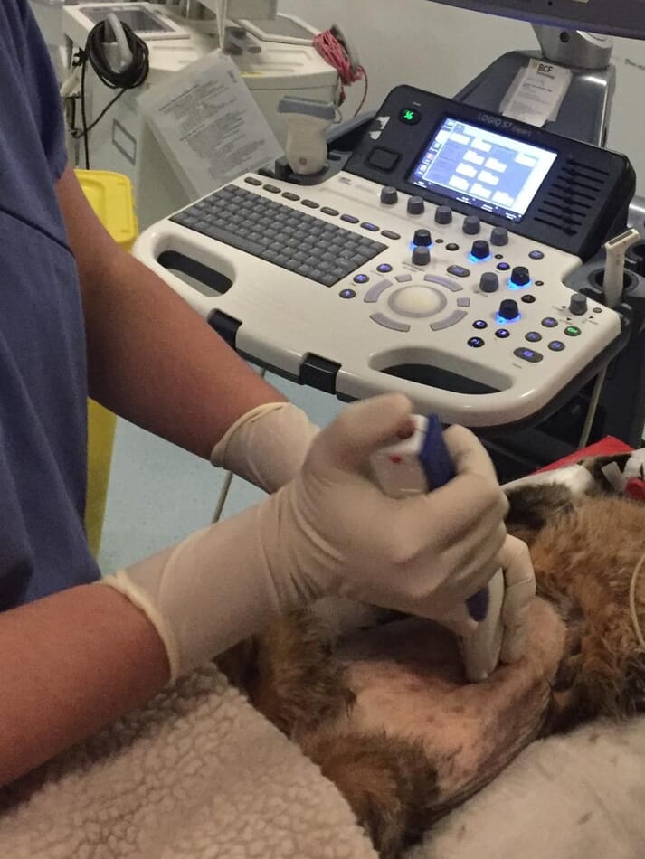 FIGURE (2) An ultrasoundguided Tru-Cut liver biopsy can be performed in an anaesthetised patient to obtain liver tissue