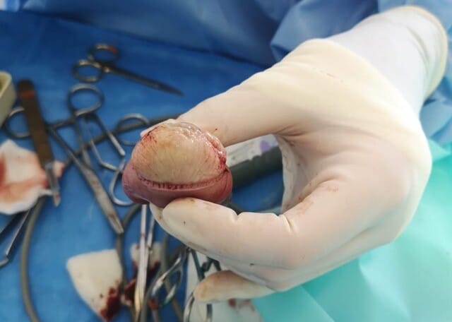 African pygmy hedgehog's infected womb