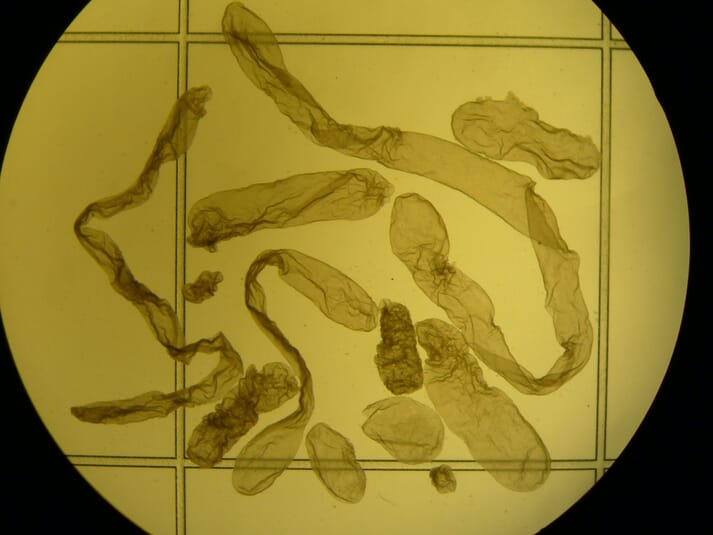 FIGURE (2) Elongat-ing bovine conceptuses on day 14 of pregnancy. Note the large variation in conceptus length which is associated with likelihood of pregnancy establishment