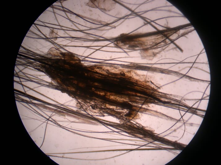 Microscopic image of dog hair