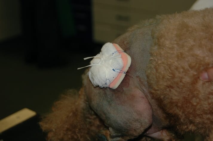 Wound dressing