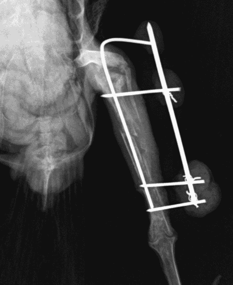 FIGURE (3) Use of a hybrid type II external skeletal fixator