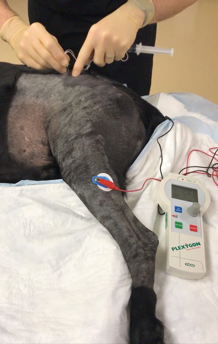 Dog leg and peripheral nerve stimulator
