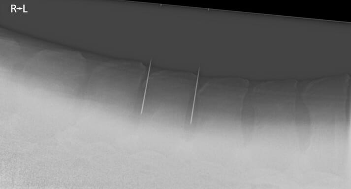 Radiograph of a horse's back