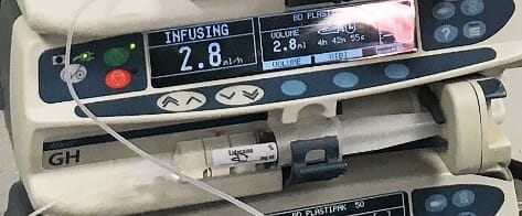 FIGURE (2) Constant rate infusion can also be administered via syringe driver, here lidocaine