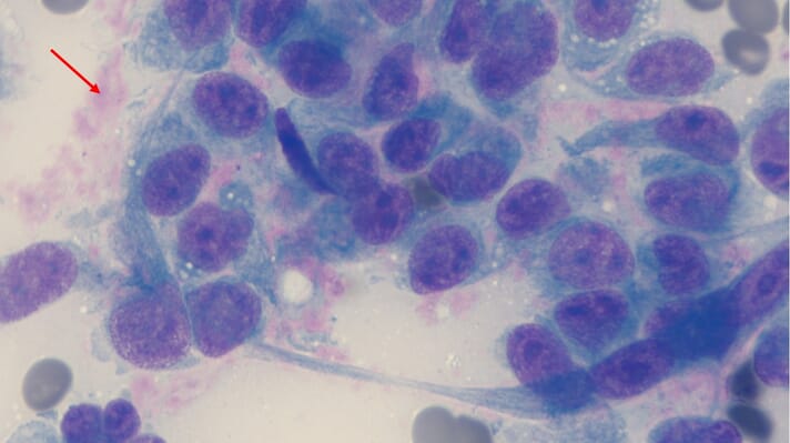 Cytological preparation