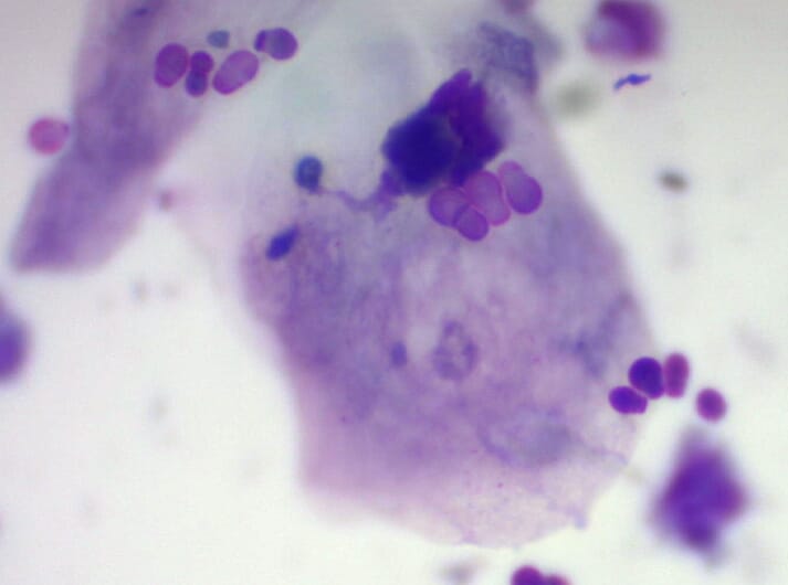 Microscopic view of Malassezia organisms