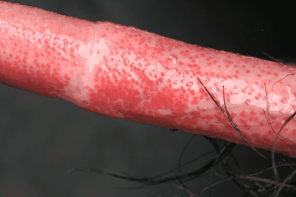 FIGURE (1) Venereal transmission of BoHV-1 is rare in the UK but can result in inflammation on the penile mucosa