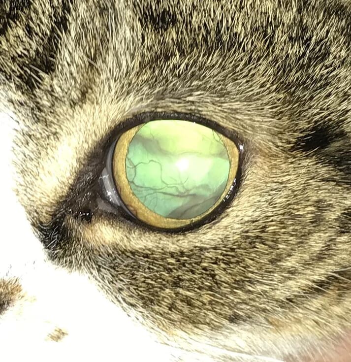 FIGURE (2) Retinal detachment is clearly evident in this blind patient upon shining a light source into the eye. SBP readings were greater than 200mmHg and the patient was treated with amlodipine which successfully returned FIGURE (2) SBP to the reference range. Vision improved following treatment although it remained impaired