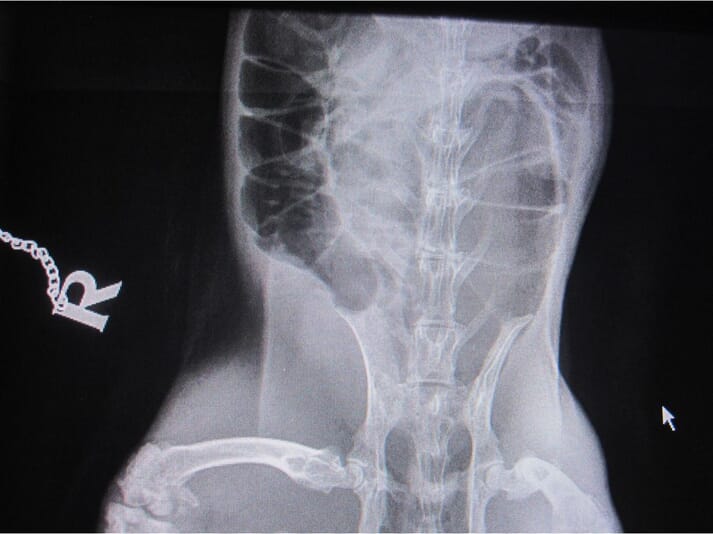 FIGURE (1) X-ray showing gas in the caecum