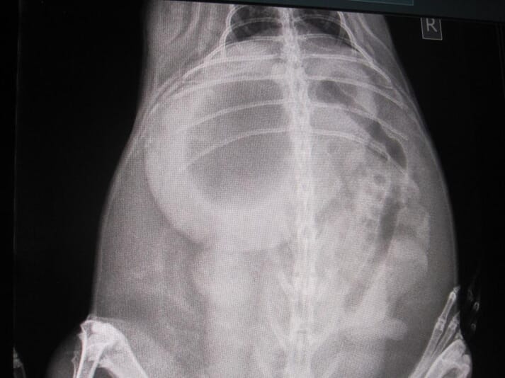 FIGURE (3) Gas cap in the stomach
