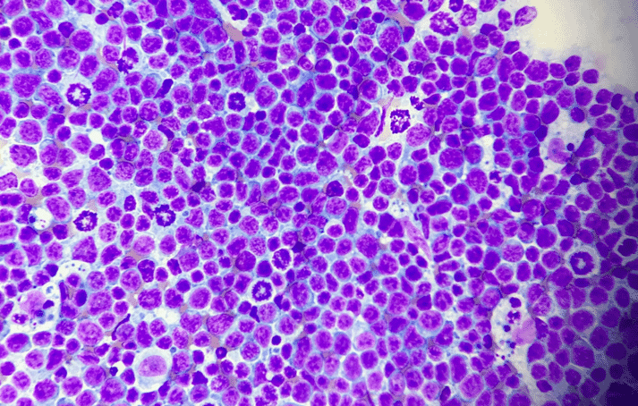 image of flow cytometry showing atypical cells