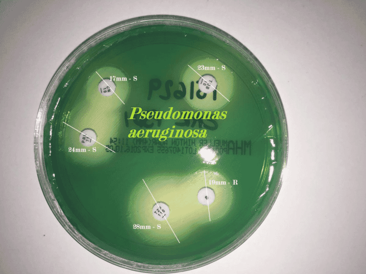 FIGURE 2 Only a limited panel of antibiotics can be tested for Pseudomonas aeruginosa, which has developed intrinsic resistance to multiple first-line antibiotics