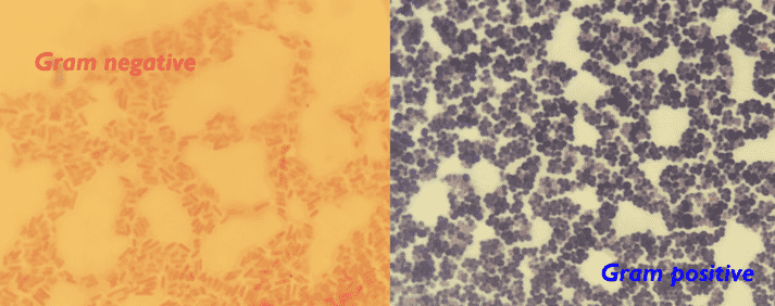 FIGURE 3 Gram staining can greatly narrow down the choice of antibiotics available for use
