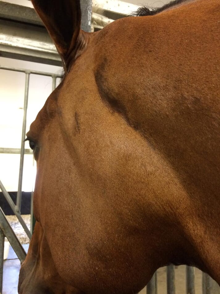 (A) Antibiotics should be considered in cases with profound lymphadenopathy and subsequent respiratory distress