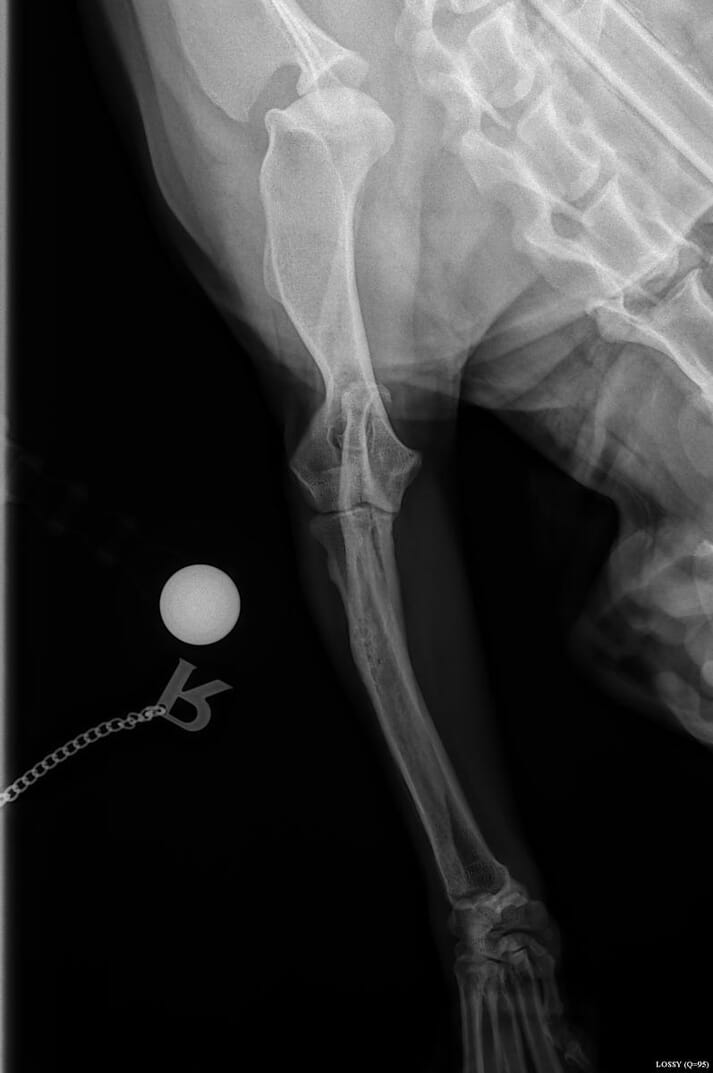 FIGURE (1) A craniocaudal view showing a radiolucency line between the condyles