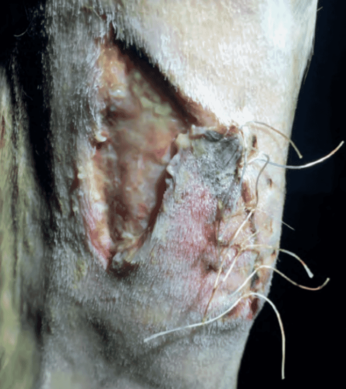 FIGURE 1 This wound is in the inflammatory phase, so appears yellow and sloughy. This is a normal presentation for a wound at two days old. Clinically, debridement and lavage will reduce the bioburden, enabling the re-modelling ‘switch’ to progress and for the wound to granulate. The wound is not communicating with any vital structures and inflammation is isolated to the wound. Is antibiotic use necessary to aid healing in this case?