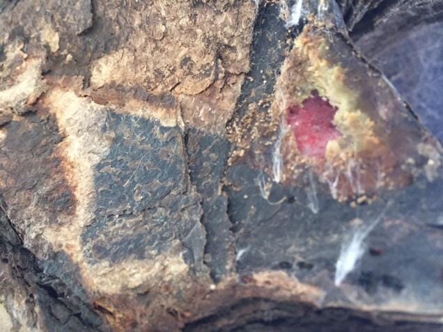 FIGURE (2) A shell wound involving epidermis and underlying dermal bone with no fractures would be classified as a moderate injury