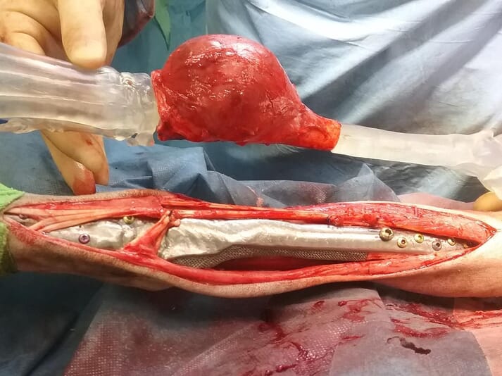 Bespoke pancarpal arthrodesis plate – distal radial tumour (images supplied by CBM wales: www.cbmwales.co.uk)