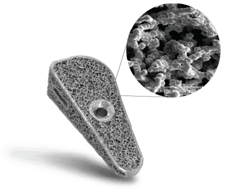 Fusion TTA implant