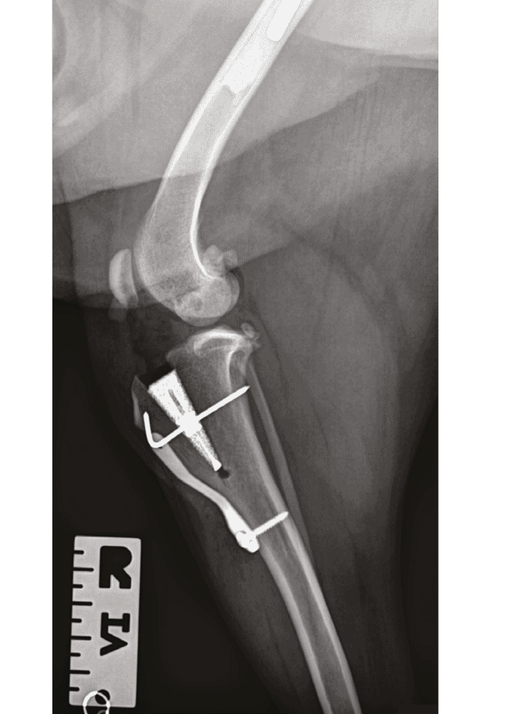 Fusion TTA post-op radiograph (images supplied by Fusion Implants: www.fusionimplants.com)