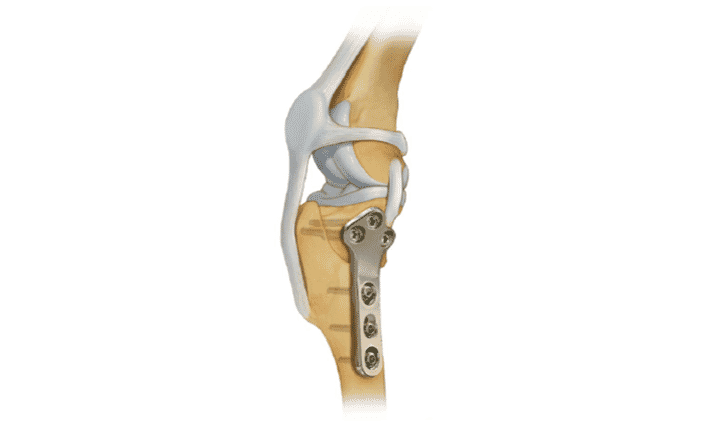 Tibial Plateau Levelling Osteotomy (TPLO): an overview | Veterinary ...