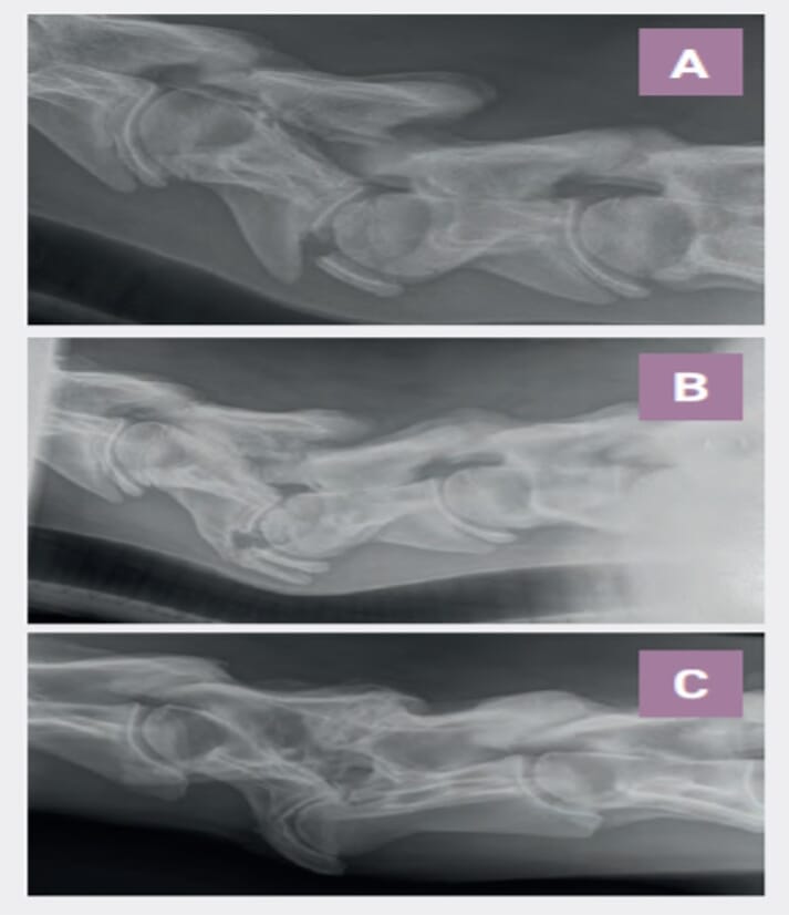 FIGURE 1 (A) laterolateral radiograph of the mid cervical region of an eight-month-old Warmblood colt which presented with acute onset ataxia and neck pain, showing fracture of the 4th cervical vertebra and severe disruption of the intervertebral articulation. The horse was managed conservatively and repeat radiographs at six weeks (B) and four years (C) show progressive callus formation. The horse went on to make a full recovery and successfully performed at dressage